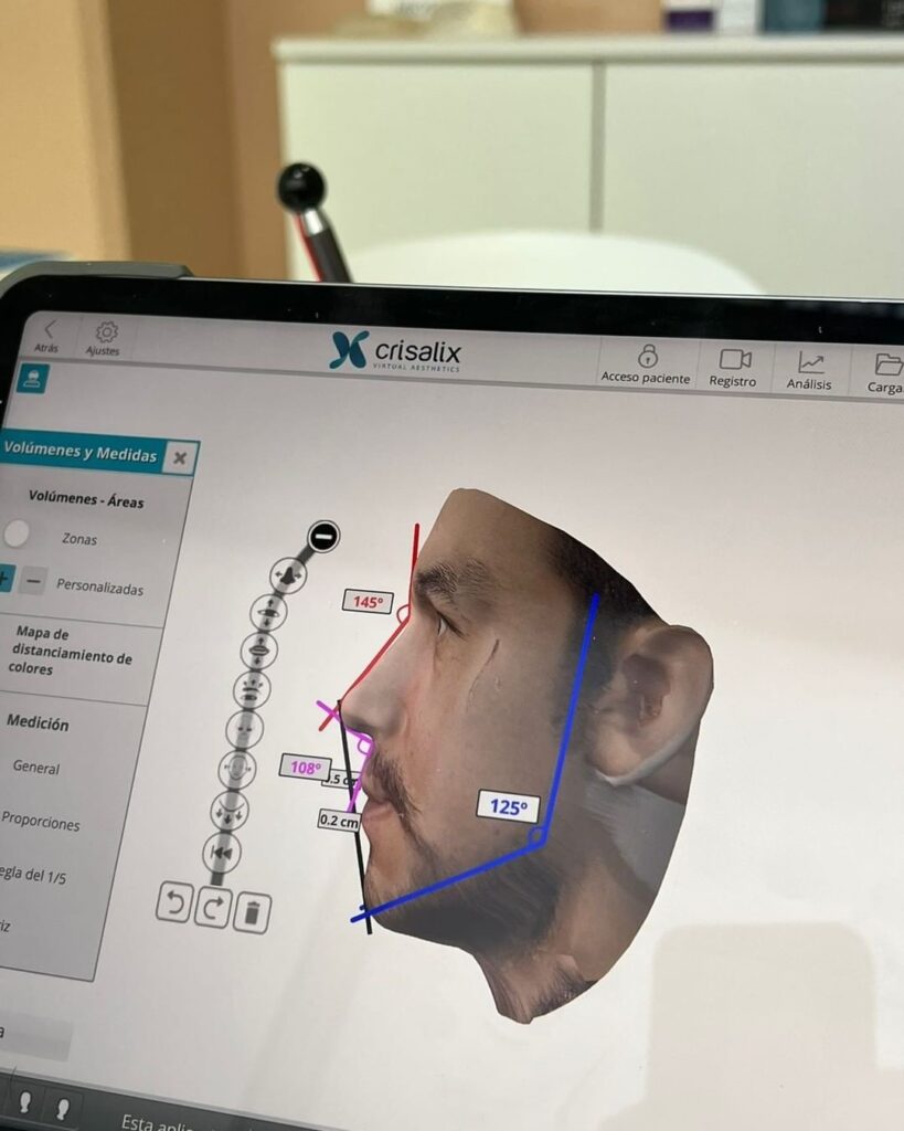 Crisalix D Simulation For Your Plastic Surgery In Lima Peru