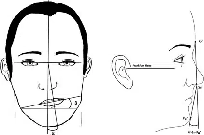 Asimetría facial – condilectomía Facial Asymmetry