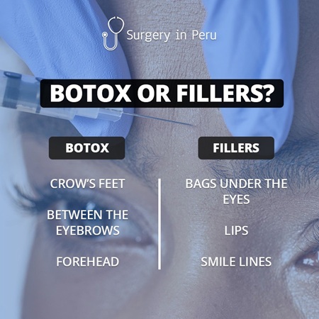Hyaluronic Acid Fillers in Lima, Peru