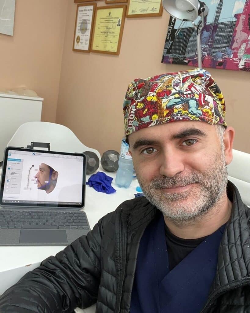 rhinoplasty in lima
