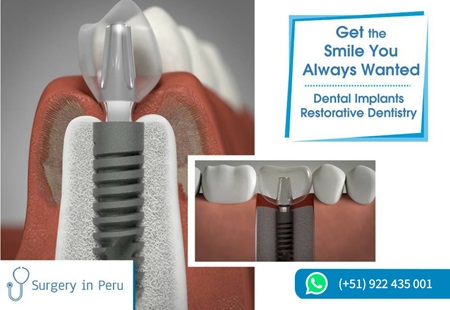 dental surgery in peru