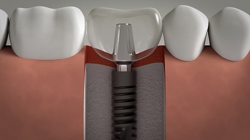oral surgery