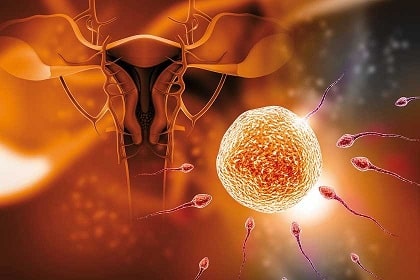 Fecundación in Vitro