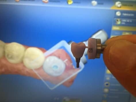 tratamientos dentales en Peru