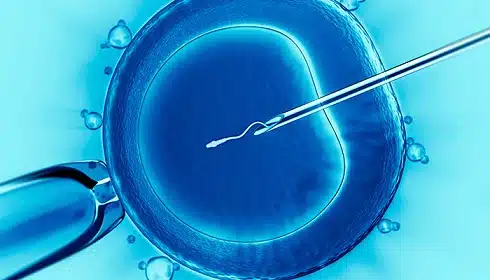 Intracytoplasmic Sperm Microinjection lima peru Intracytoplasmic Sperm Microinjection