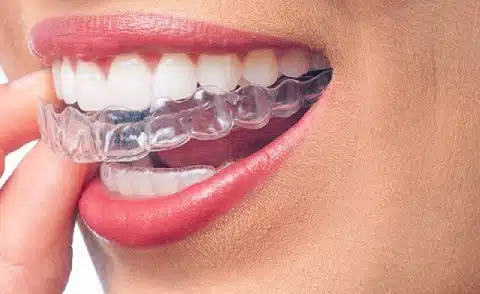 orthodontics