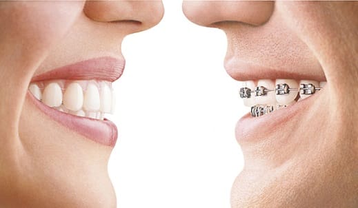 orthodontics