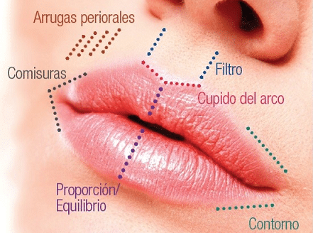 Lifting-de-labio-lima peru
