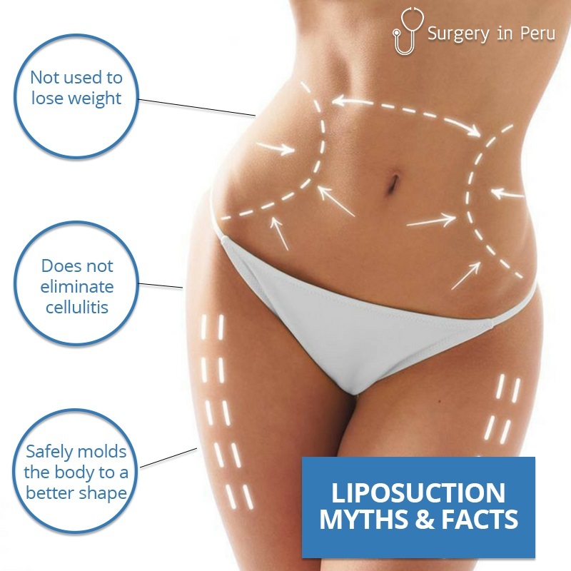 abdominoplasty vs liposuction comparison