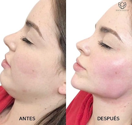 jawline profiling