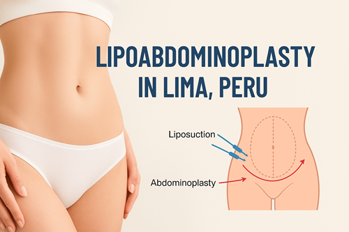 Lipoabdominoplasty in Lima