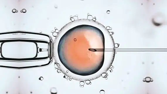 Intracytoplasmic sperm microinjection (ICSI)