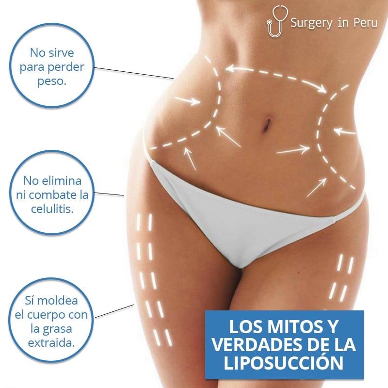 Mitos-y-verdades-de-la-liposuccion