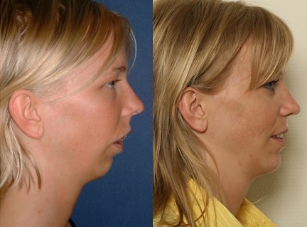 oral surgery