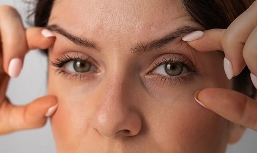Myths about Blepharoplasty