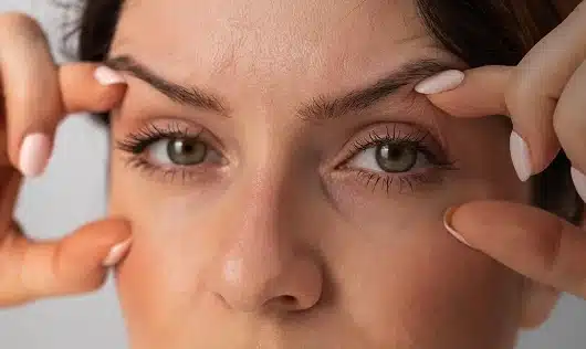 Myths about Blepharoplasty
