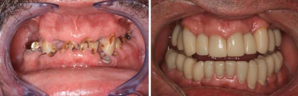 oral surgery lima