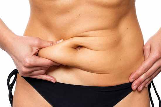 abdominoplastia precio peru