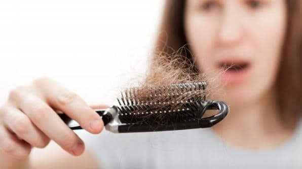 alopecia femenina