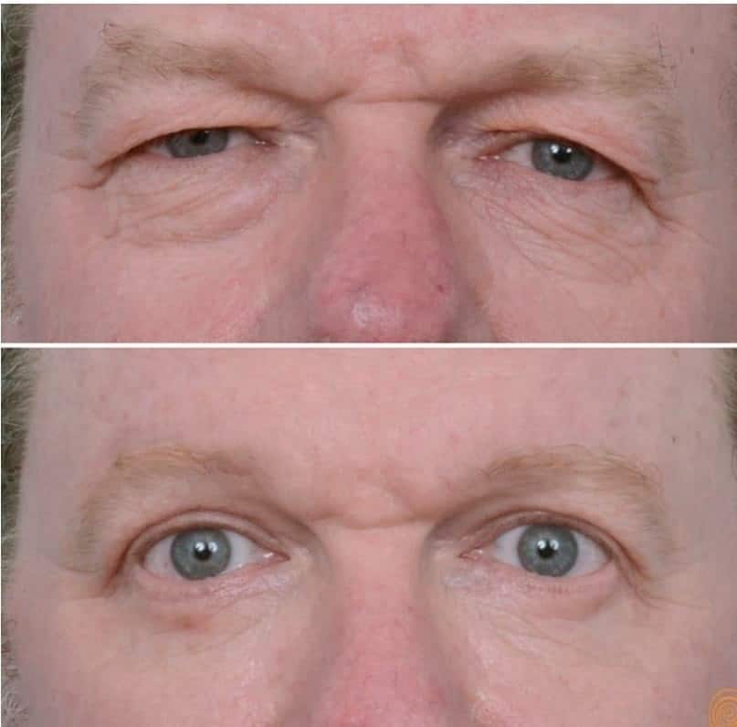 cirugía plástica facial