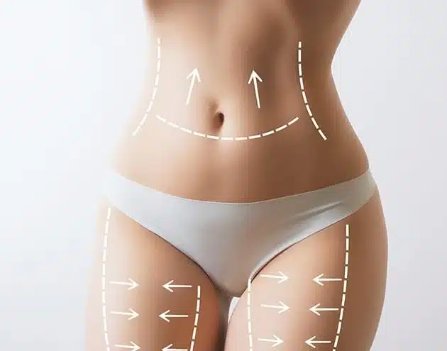 body-contouring-hero