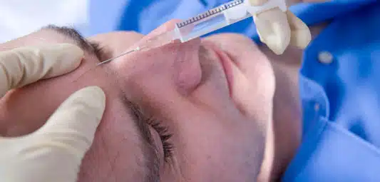 botox lima peru