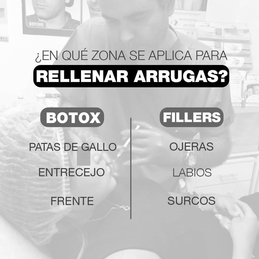 Acido hialurónico