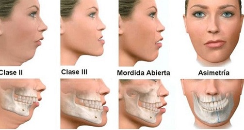 Maxillofacial Surgery