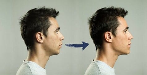 definición de la mandíbula masculina