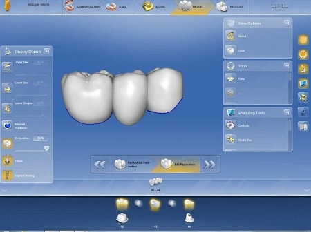 Dental Implant Technology in Lima | Dental Surgery in Peru