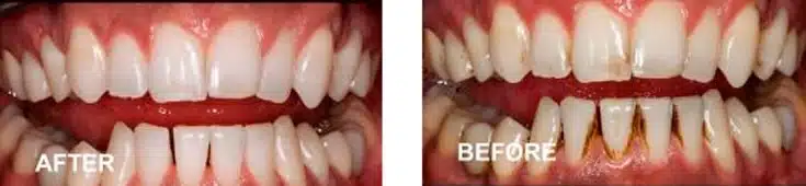 dental-whitening-surgery-peru