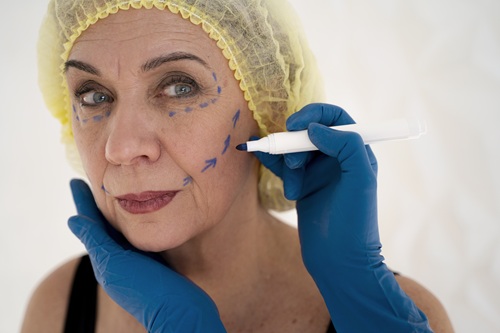 injerto de grasa facial