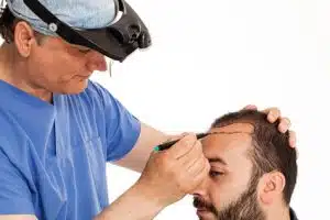 Hair transplant