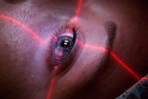 cirugía ocular LASIK