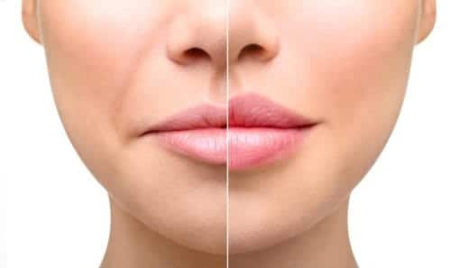 lip-lift-lima-peru