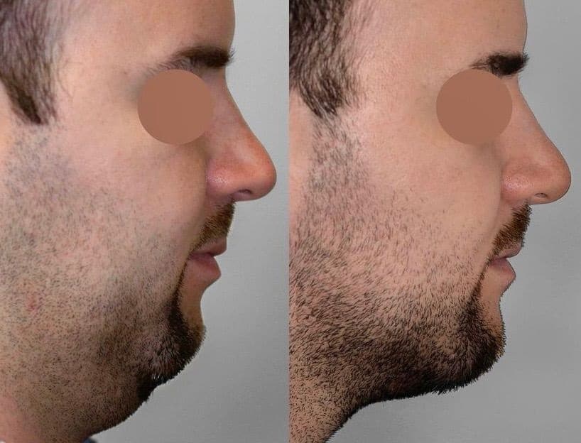 daddy makeover lipopapada hombre