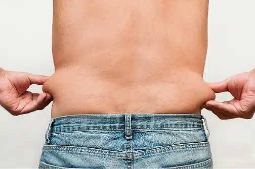 love_handles_lima peru liposuction for men