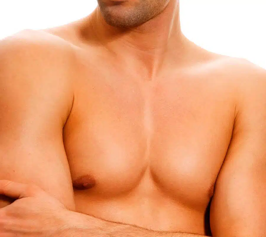 Male Breast Reduction male breast reduction