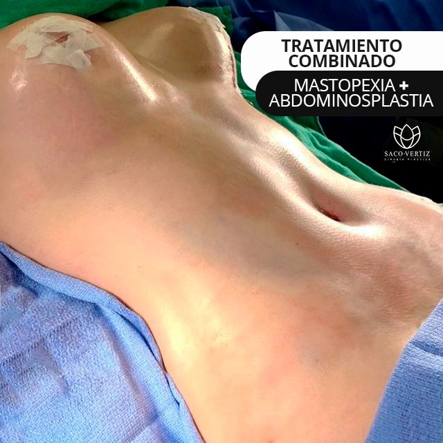 mastopexia abdominoplastia