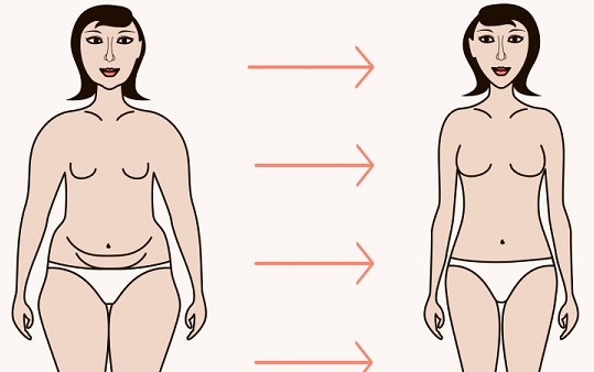 mommy makeover