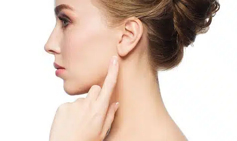 otoplasty