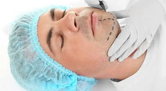 rhinomentoplasty lima rhinomentoplasty