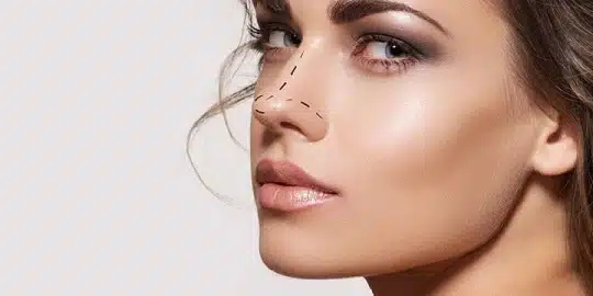 riesgo rinoplastia