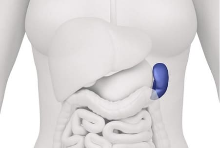 splenectomy