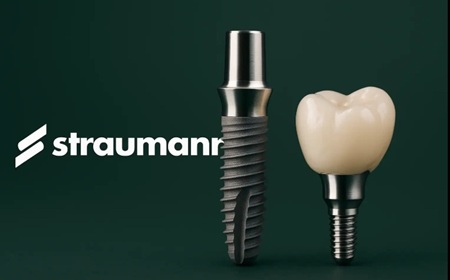 traumann-dental-implants-lima