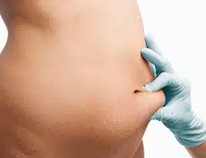 surgery-in-peru--08