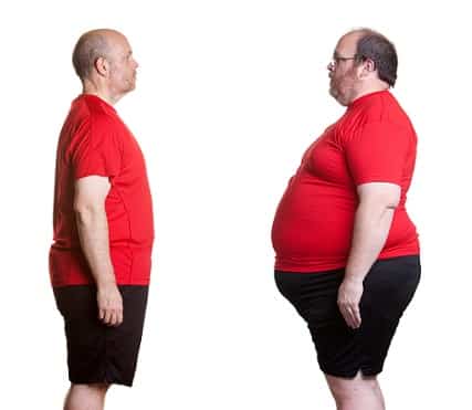 Gastric Bypass