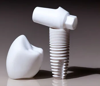 zirconium dental implant1 Implantes Dentales de Zirconio en Lima, Perú